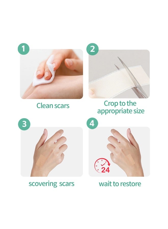 Generic 2 packs of Silicone Scar Patch, Fade Scar Sticker, Efficient Beauty Scars Removal Cesarean Section Burn Scars Left Behind Gel Painless Tape Roll (4cm * 1.5m)  - Image 5