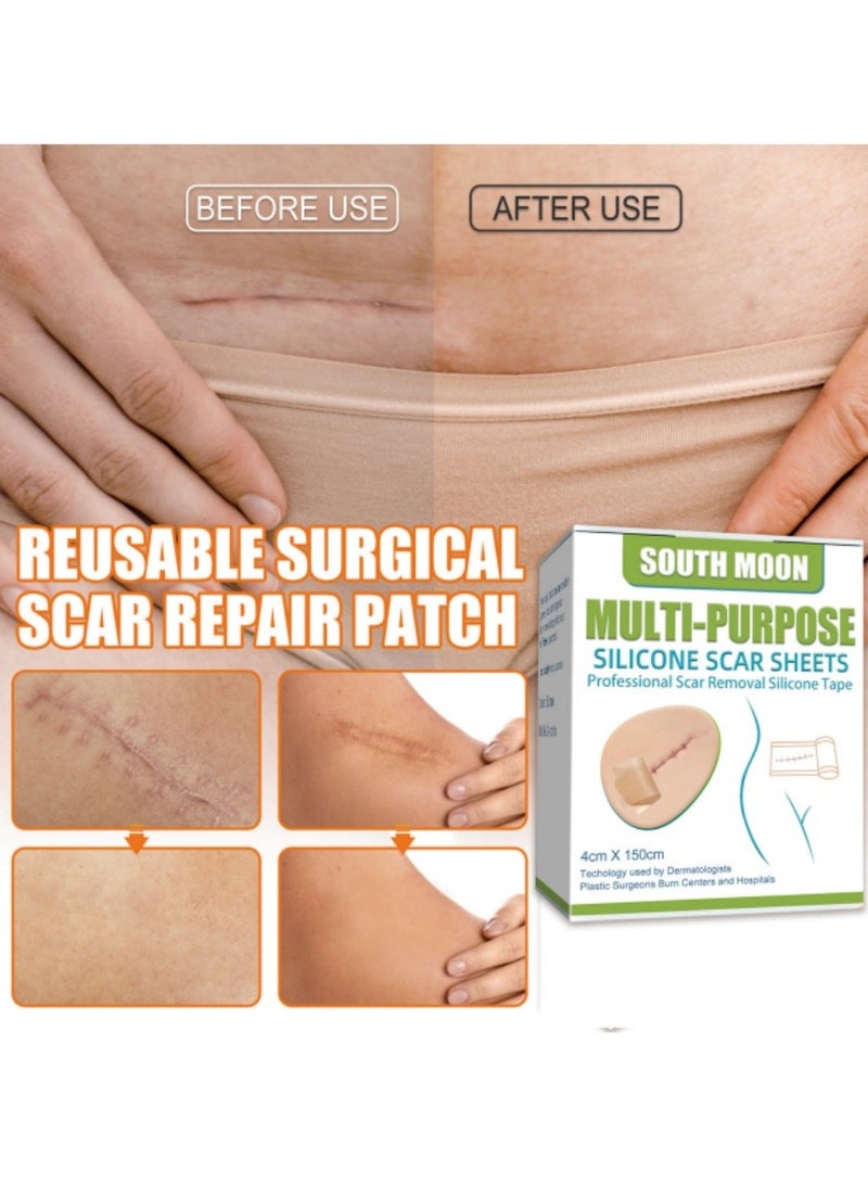 ساوث مون رقعة الندبات المصنوعة من السيليكون لإزالة الندبات التجميلية الفعالة لإزالة الندبات الناتجة عن العمليات القيصرية وندوب الحروق وغيرها من الندبات المتبقية من الجل بشريط لاصق غير مؤلم (4 سم × 1.5 متر) - Image 2