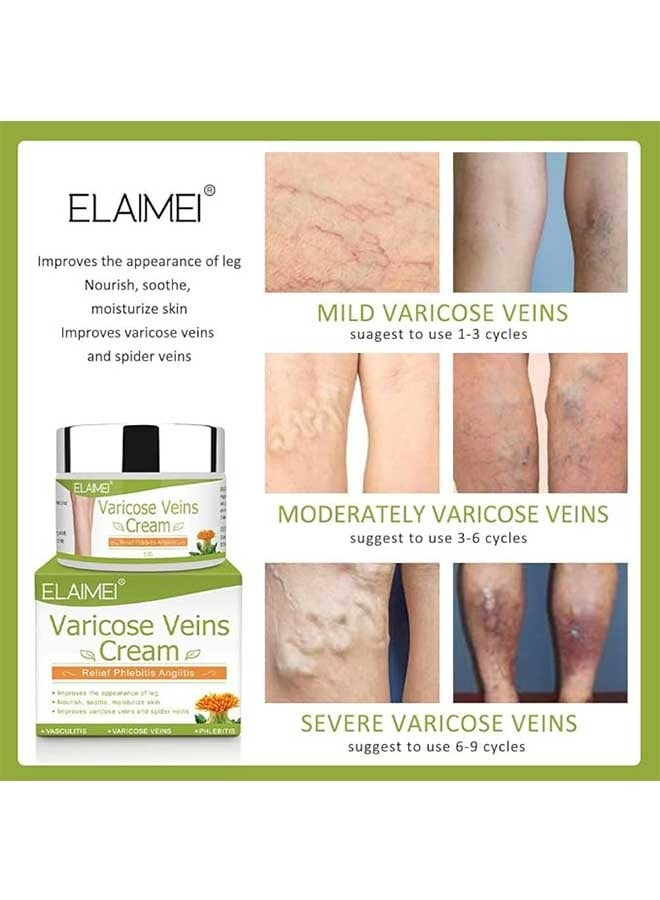 Elaimei Varicose Veins Cream, Soothing Leg Cream, Varicose and Spider Veins Treatment Cream, Relieve Phlebitis Angiitis, Improve Blood Circulation, Fast Relieve Swelling Pain 50g  - Image 4