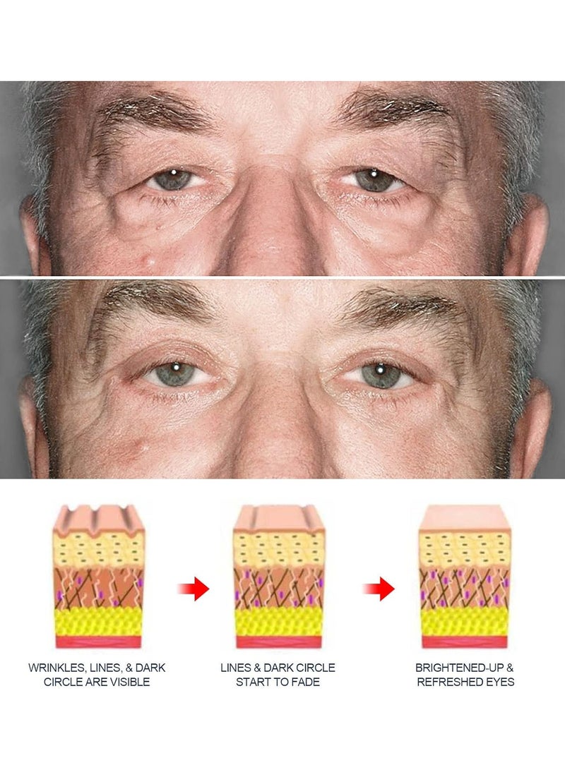 East Moon كريم العين للرجال بارد وناعم كريم مضاد للانتفاخ جل العين ببتيد مضيء - Image 4