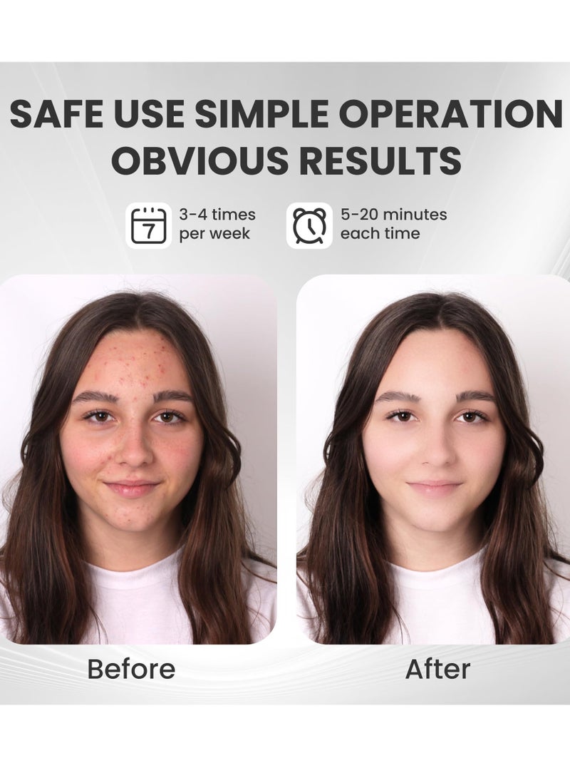 العلاج بالضوء الأزرق لعلاج حب الشباب قناع الوجه LED ذو 7 ألوان العلاج بالضوء قناع العلاج بالضوء الأزرق والأحمر لعلاج التجاعيد وحب الشباب قناع العناية بالبشرة بالفوتونات قناع - Image 4