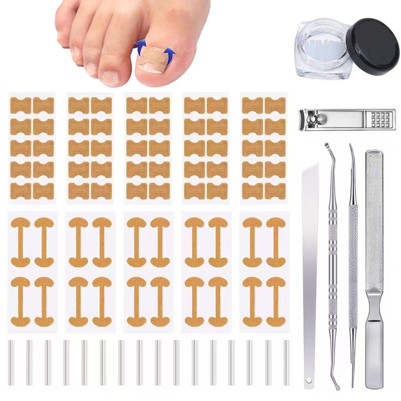 CHEMAILON Professional Ingrown Toenail Toolkit with Breathable Ingrown Toenail Strips, Curved Toenails Corrector Patch, Painless File and Lifter for Home Pedicure Care - Image 1