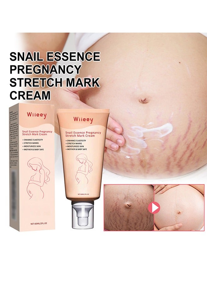 wiieey Snail Essence Pregnancy Stretch Mark Cream, Stretch Marks And Scar Removal Cream For Pregnancy, Stretch Marks Scar Belly Creams For Wrinkles, Obesity Fat Stretch Mark Moisturizing, Remove Marks-60ml  - Image 1