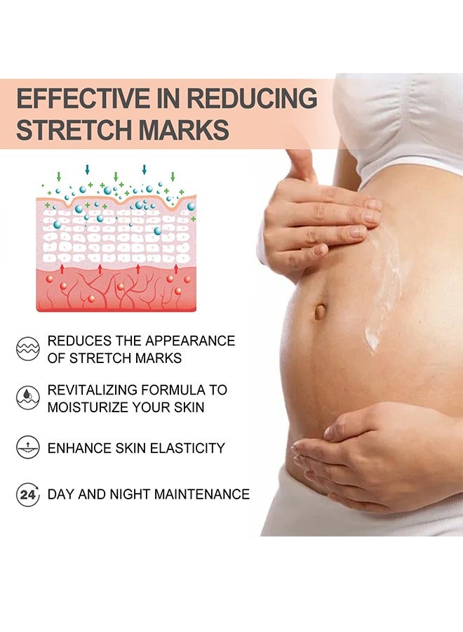 wiieey Snail Essence Pregnancy Stretch Mark Cream, Stretch Marks And Scar Removal Cream For Pregnancy, Stretch Marks Scar Belly Creams For Wrinkles, Obesity Fat Stretch Mark Moisturizing, Remove Marks-60ml  - Image 2