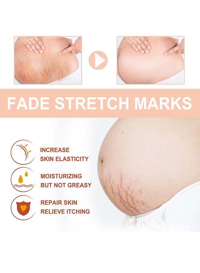wiieey Snail Essence Pregnancy Stretch Mark Cream, Stretch Marks And Scar Removal Cream For Pregnancy, Stretch Marks Scar Belly Creams For Wrinkles, Obesity Fat Stretch Mark Moisturizing, Remove Marks-60ml  - Image 4