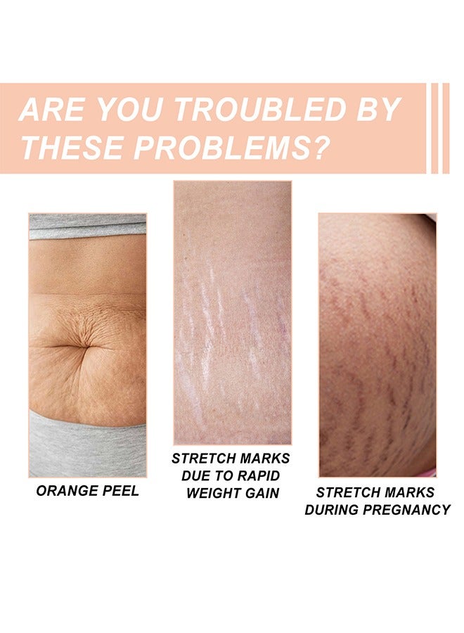 wiieey Snail Essence Pregnancy Stretch Mark Cream, Stretch Marks And Scar Removal Cream For Pregnancy, Stretch Marks Scar Belly Creams For Wrinkles, Obesity Fat Stretch Mark Moisturizing, Remove Marks-60ml  - Image 3