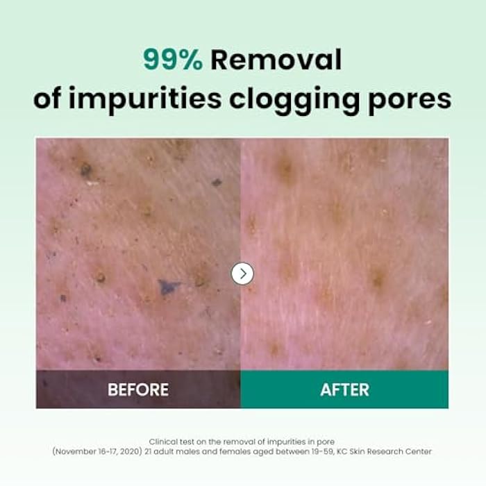 Dr. G Dr.G pH Cleansing Gel Foam - Everyday Gentle Face Cleanser for All Skin Types - pH-Balanced - Hydrating - Deep Pore Cleansing - Safe for Daily Use on Sensitive Skin - Korean Skincare - 10.14 fl oz - Image 3