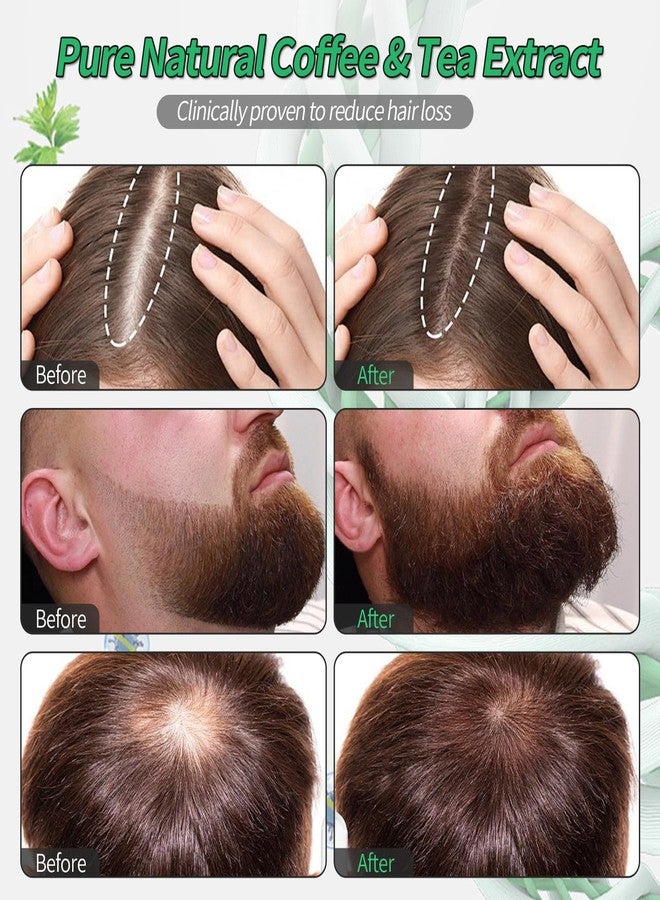 W3W Hair Growth Serum, Orrenaturals Hair Revival Ampoule 3% Rosemary Hair Growth Serum Roll On 30ml Scalpy Hair Growth Oil for Hair Loss&Thinning - Image 3