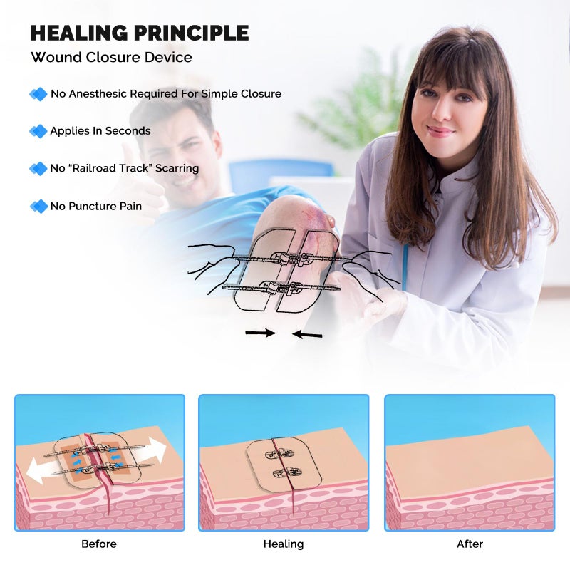 Greetmed 4 Pack Emergency Wound Closure Strips, Double Zip Wound Closure Device, Butterfly Stitches Alternative, Suture-Free Skin Closure for Home First Aid Kits & Outdoor Use - Image 4