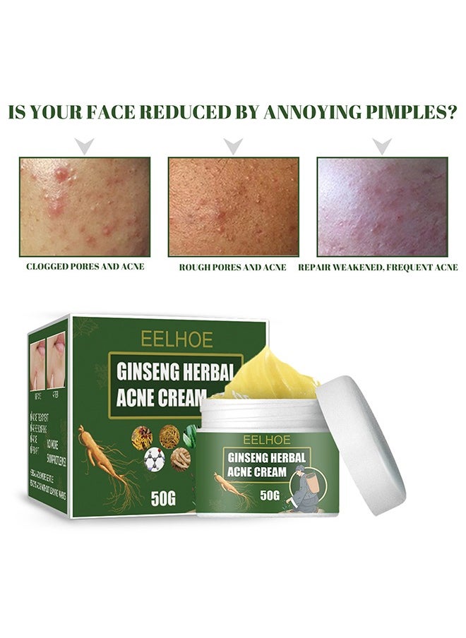 EELHOE Ginseng Herbal Acne Cream - Herbal Acne Treatment Cream Pimple Spot Removal Control Acne Scar Cream Shrink Pores Skin Care Beauty Health  - Image 3