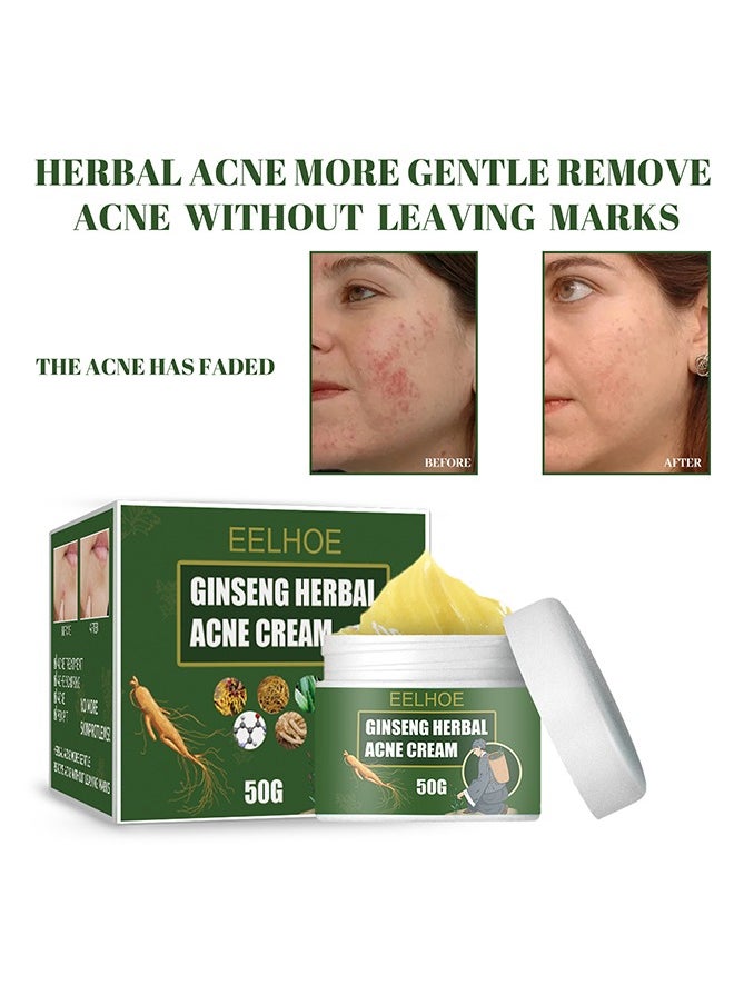 EELHOE Ginseng Herbal Acne Cream - Herbal Acne Treatment Cream Pimple Spot Removal Control Acne Scar Cream Shrink Pores Skin Care Beauty Health  - Image 4