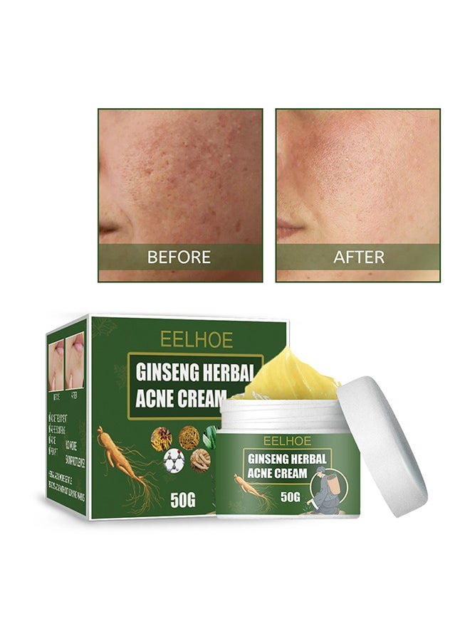 EELHOE Ginseng Herbal Acne Cream - Herbal Acne Treatment Cream Pimple Spot Removal Control Acne Scar Cream Shrink Pores Skin Care Beauty Health  - Image 1