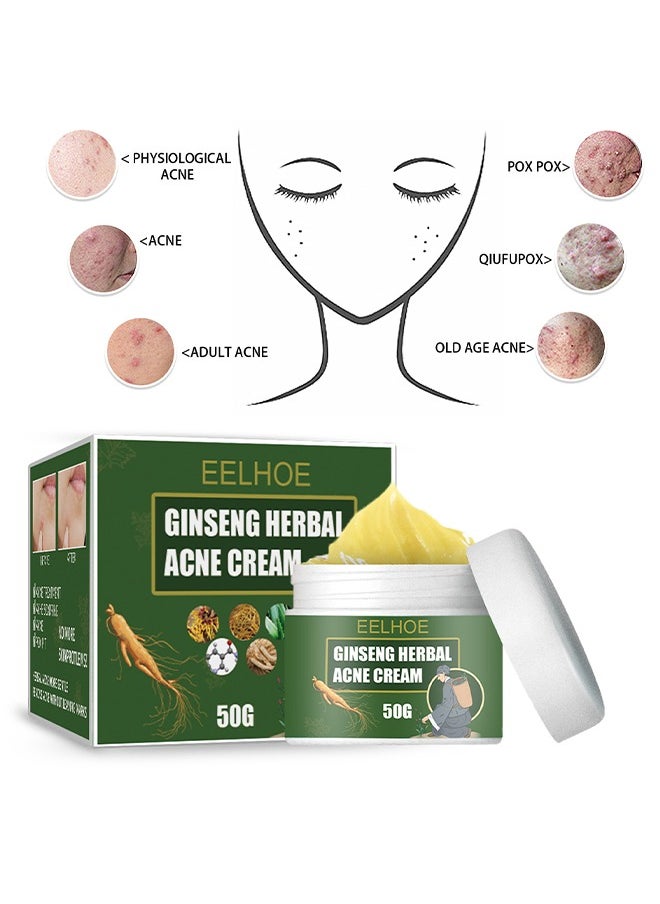 EELHOE Ginseng Herbal Acne Cream - Herbal Acne Treatment Cream Pimple Spot Removal Control Acne Scar Cream Shrink Pores Skin Care Beauty Health  - Image 2