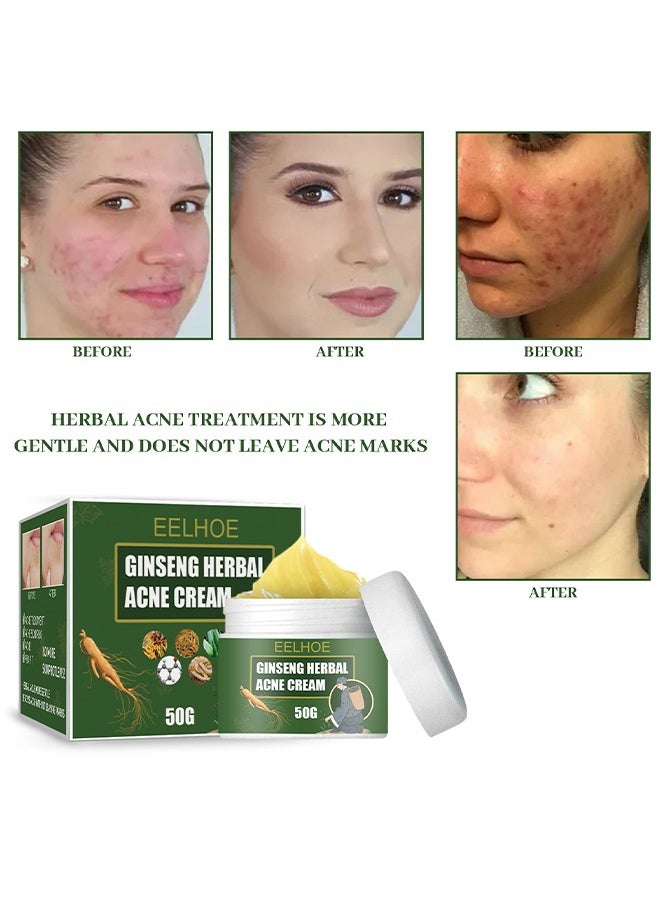 EELHOE Ginseng Herbal Acne Cream - Herbal Acne Treatment Cream Pimple Spot Removal Control Acne Scar Cream Shrink Pores Skin Care Beauty Health  - Image 5