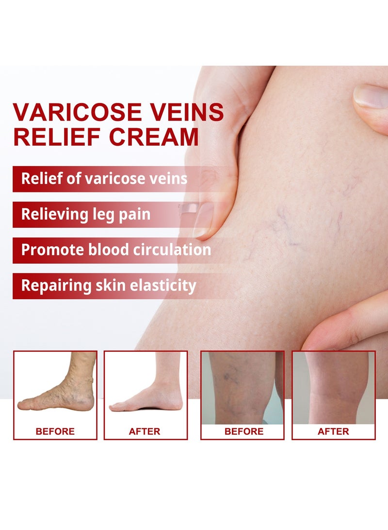 SOUTH MOON 3-PACK Varicose Vein Soothing Cream, Reduce Varicose Veins, Relieve Swelling And Pain 20g*3  - Image 4