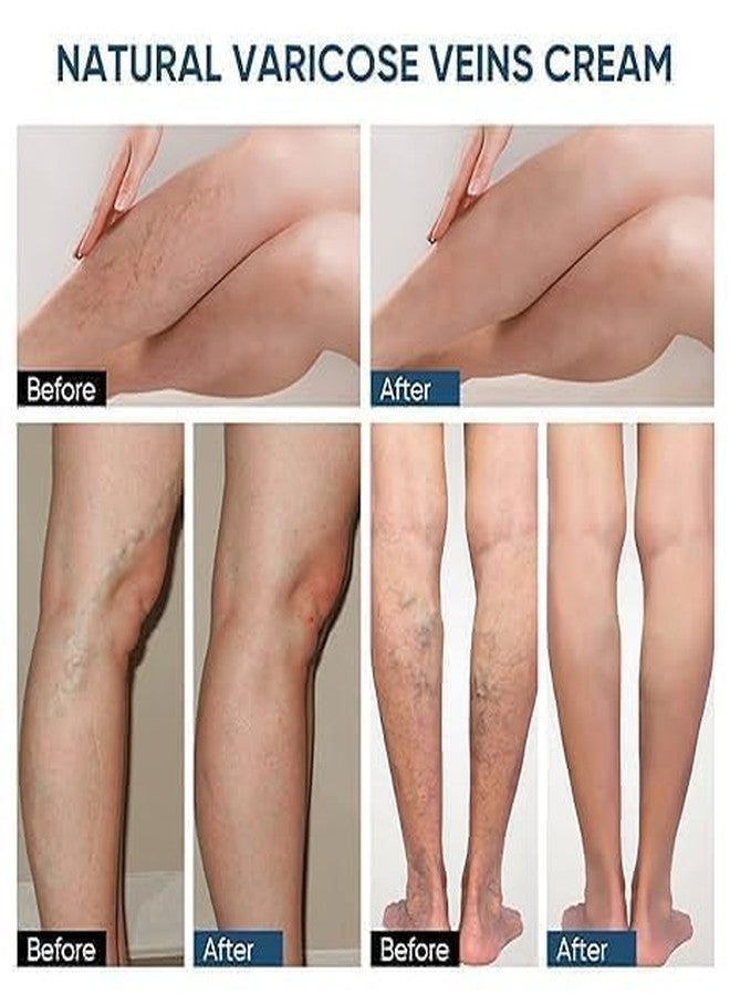 Delightbee Varicose Veins Relief Patches for Legs (36 PCS) – Herbal Leg Support Patch with Turmeric & Natural Extracts – Comfortable Adhesive for Tired & Heavy Legs – For Men & Women - Image 4