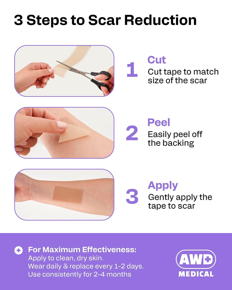 AWD Medical AWD Silicone Scar Tape 120in Long Roll â€“ Silicone Scar Sheets for Surgical Scars, C Section, Keloid â€“ Medical Grade Scar Tape for Bump Removal & Postpartum Essentials (120in) - Image 3