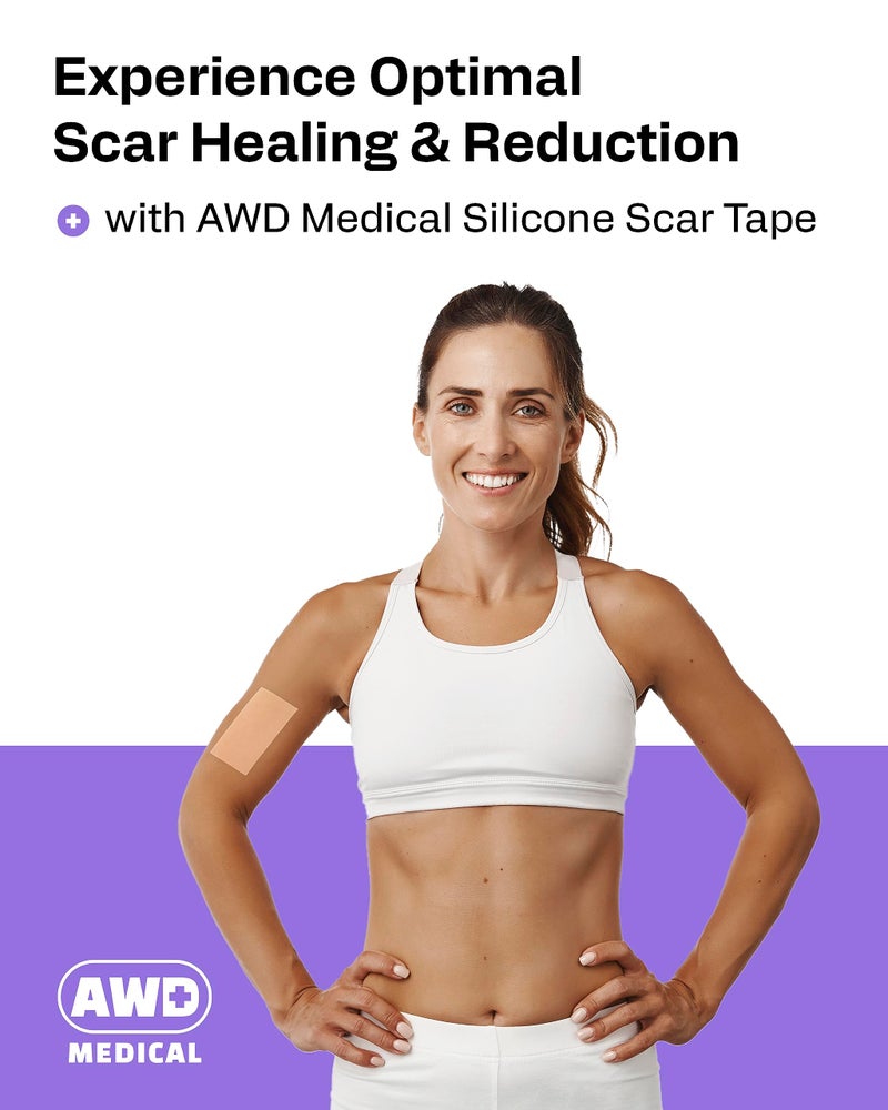 AWD Medical AWD Silicone Scar Tape 120in Long Roll â€“ Silicone Scar Sheets for Surgical Scars, C Section, Keloid â€“ Medical Grade Scar Tape for Bump Removal & Postpartum Essentials (120in) - Image 2