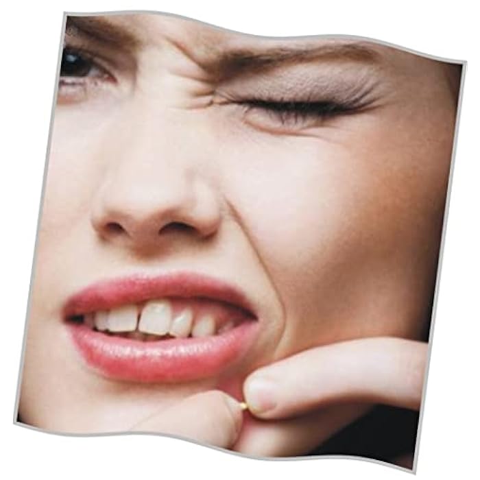 ACM Laboratoire dermatologique Sebionex trio anti-imperfections cream 40ml - Image 4