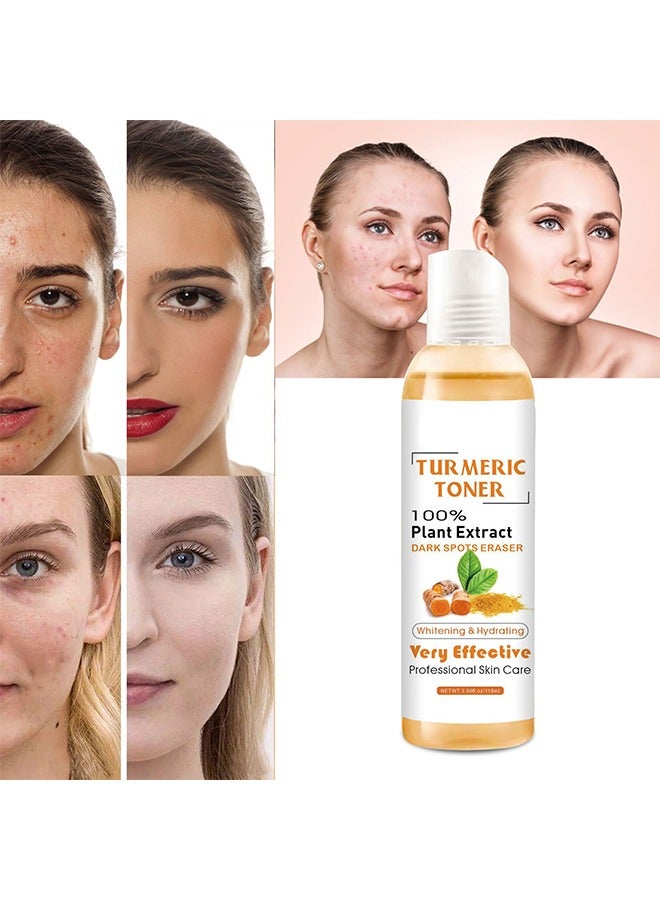 OUHOE Turmeric Toner 100% Plant Extract Dark Spots Eraser, Corrector Toner 118ML Facial Toner For Acne Prone Skin Dark Spot Remover For Face Hydrating Face Toner For Women Treatment  - Image 4