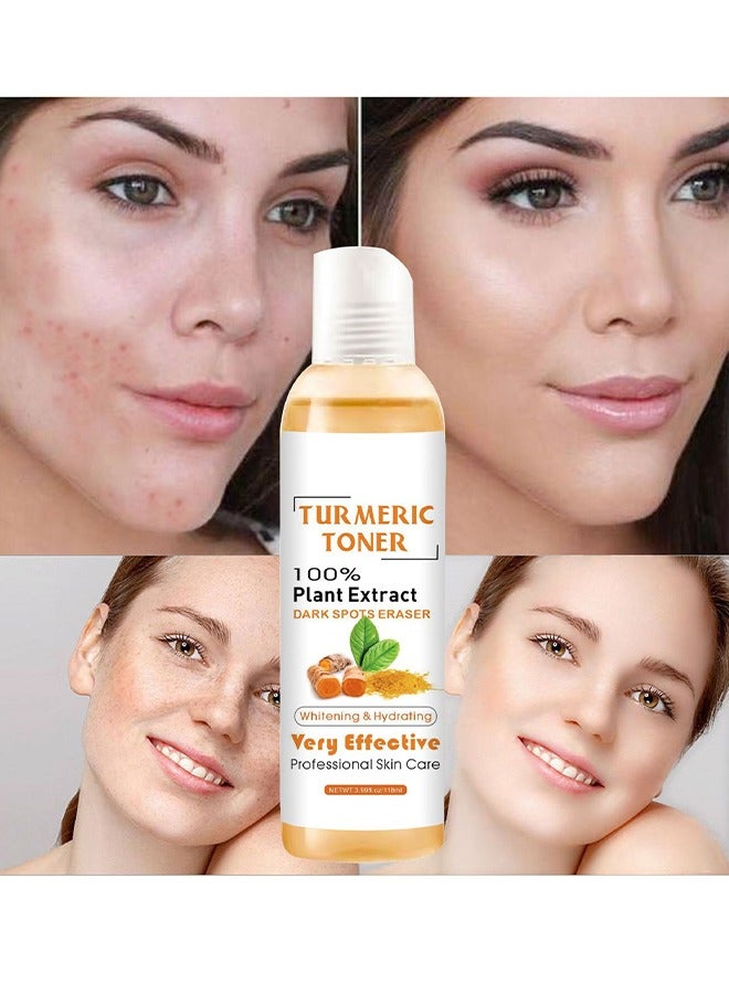 OUHOE Turmeric Toner 100% Plant Extract Dark Spots Eraser, Corrector Toner 118ML Facial Toner For Acne Prone Skin Dark Spot Remover For Face Hydrating Face Toner For Women Treatment  - Image 1