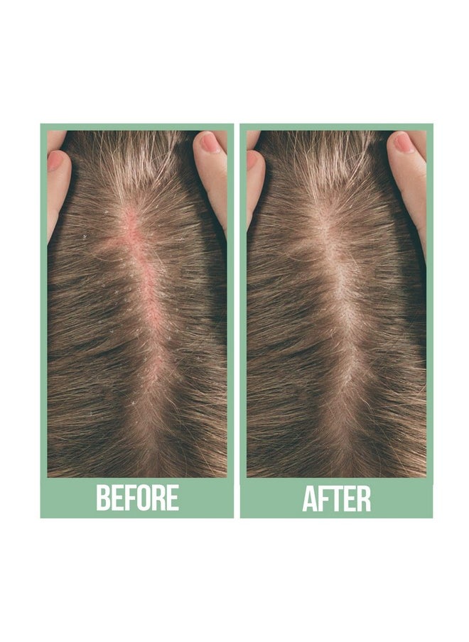 difeel Scalp Care 99% Natural Premium Natural Hair Oiltea Tree Oil 8 Oz.  - Image 2