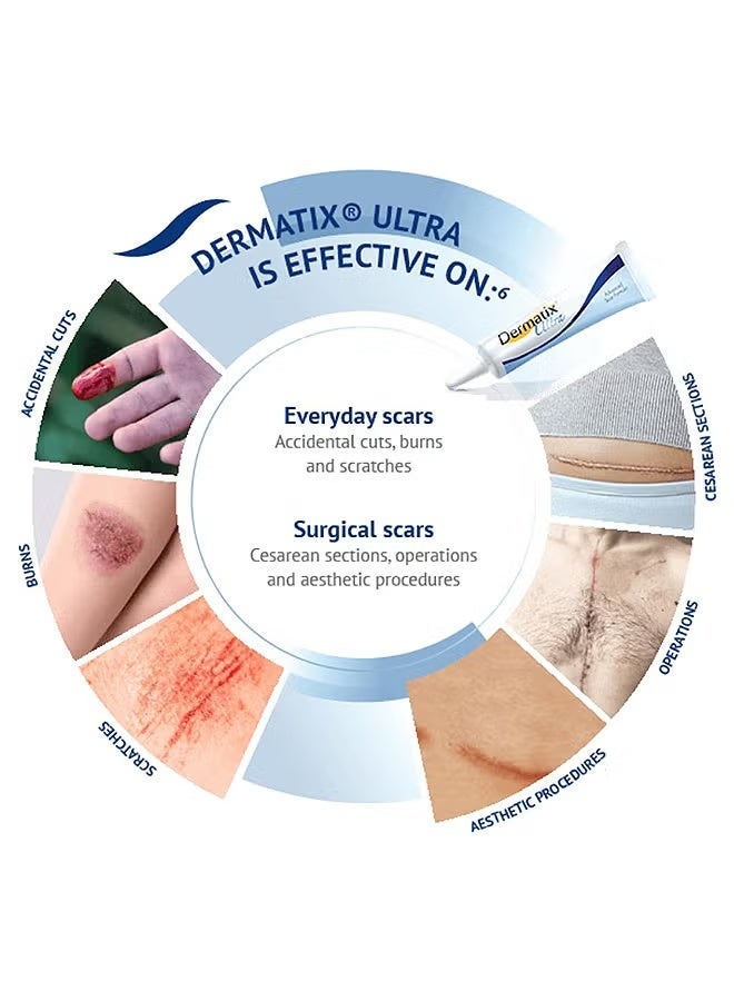Dermatix Advanced Scar Gel 15g For Cosmetic Improvement of Scars, Fast Drying and Unique Silicone Gel Formulation, Used For Treatment of Keloids, Surgical and Hypertrophic Scars, Suitable For Sensitive Skin - Image 4