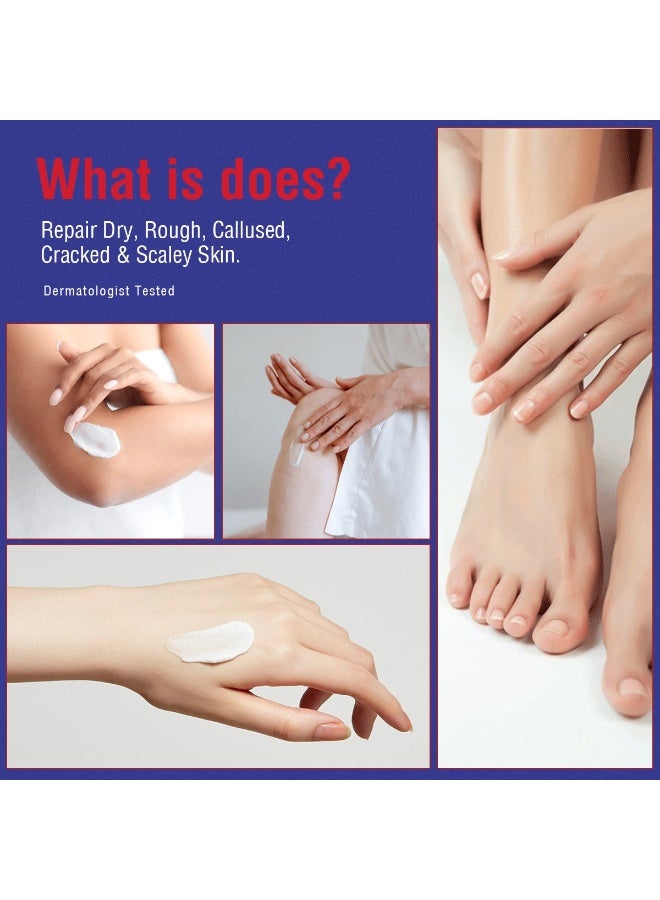 أوكييا عصا كريم اليوريا 40٪، بلسم كعب، عصا كريم اليدين والقدمين لعلاج الجفاف والشقوق، علاج للكعب المتشقق، تجنب تجمد الأقدام، لوشن اليوريا 40٪ للقدمين بأقصى قوة. - Image 2