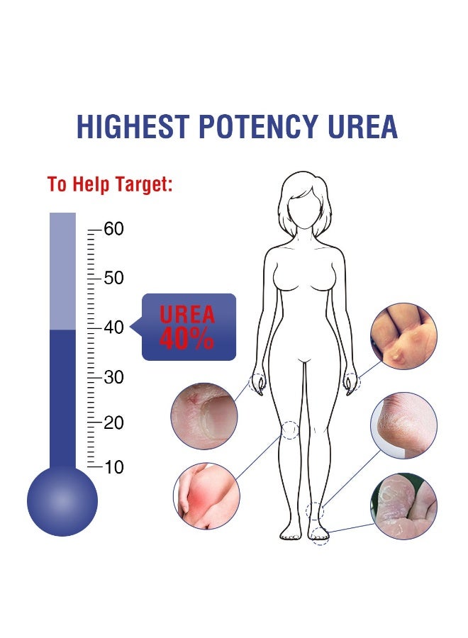 أوكييا عصا كريم اليوريا 40٪، بلسم كعب، عصا كريم اليدين والقدمين لعلاج الجفاف والشقوق، علاج للكعب المتشقق، تجنب تجمد الأقدام، لوشن اليوريا 40٪ للقدمين بأقصى قوة. - Image 3