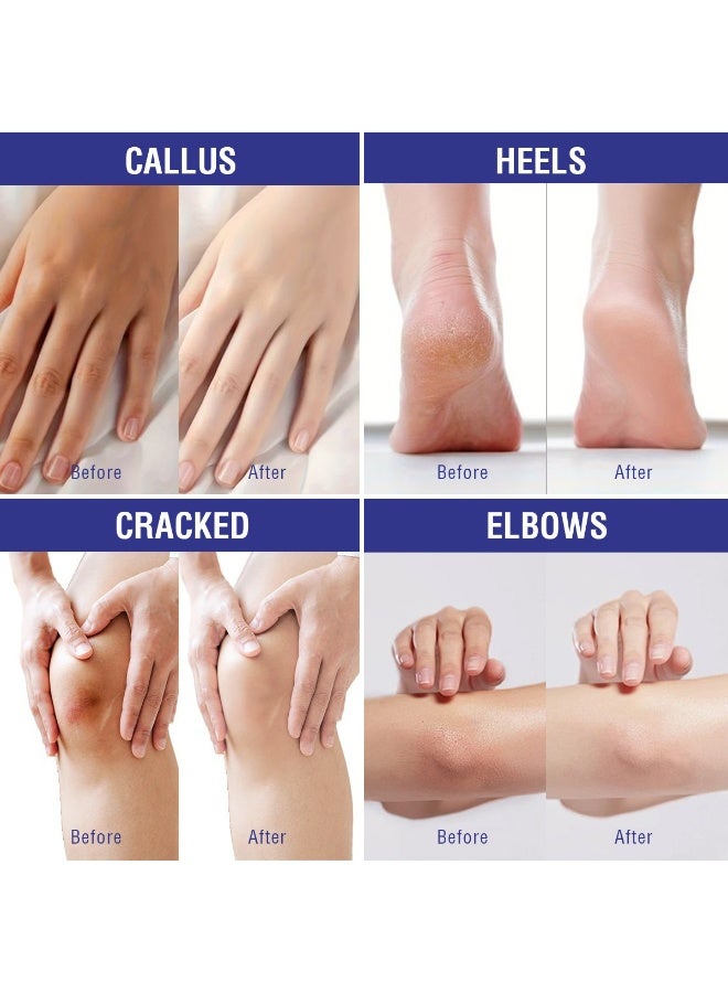 أوكييا عصا كريم اليوريا 40٪، بلسم كعب، عصا كريم اليدين والقدمين لعلاج الجفاف والشقوق، علاج للكعب المتشقق، تجنب تجمد الأقدام، لوشن اليوريا 40٪ للقدمين بأقصى قوة. - Image 5