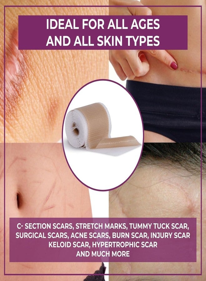 HEALQU Medical Grade Silicone Scar Sheets - Non-Irritating Scar Strips for Surgical Scars, C-Section, Tummy Tuck, and Keloid - Premium Soft Gel Strips for Pain-Free Scar Removal (1.6in x 120in) - Image 5