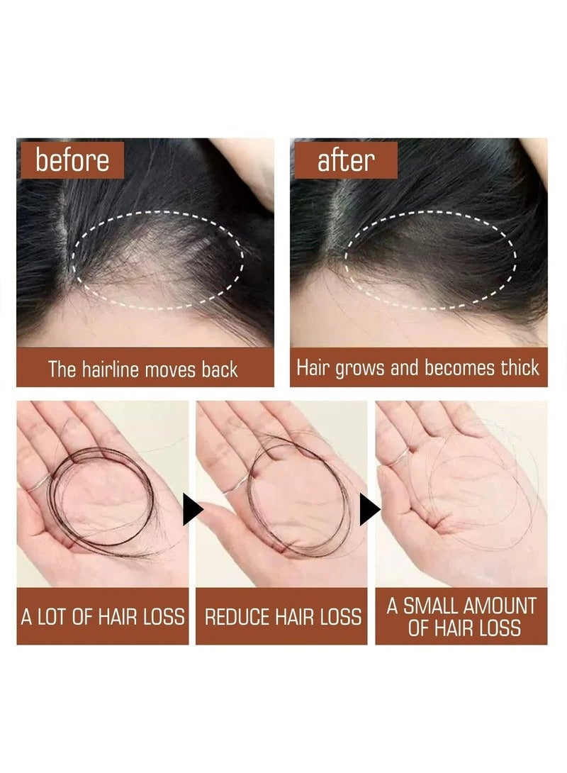 EELHOE Batana Oil for Hair Growth Healthier Thicker Fuller Hair, Batana oil, Batana Oil for Hair Growth, Batana Oil Organic, Batana Oil Organic for Healthy Hair, Batana Oil Hair Mask (1PCS) - Image 2