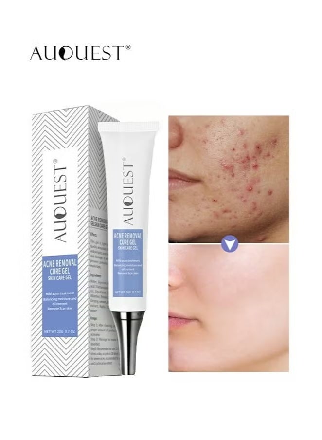 AuQuest Acne Remoyal Gure Gel -Herbal Acne Treatment Cream Pimple Spot Removal for Teens Oil Control Acne Scar Gel Shrink Pores Skin Care Beauty Health 20g - Image 1