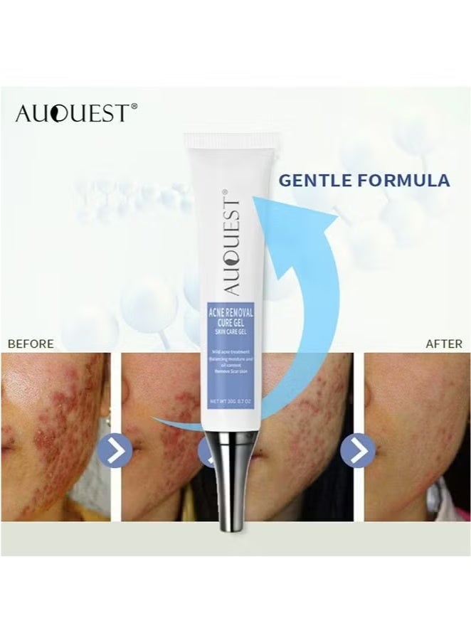 AuQuest Acne Remoyal Gure Gel -Herbal Acne Treatment Cream Pimple Spot Removal for Teens Oil Control Acne Scar Gel Shrink Pores Skin Care Beauty Health 20g - Image 4