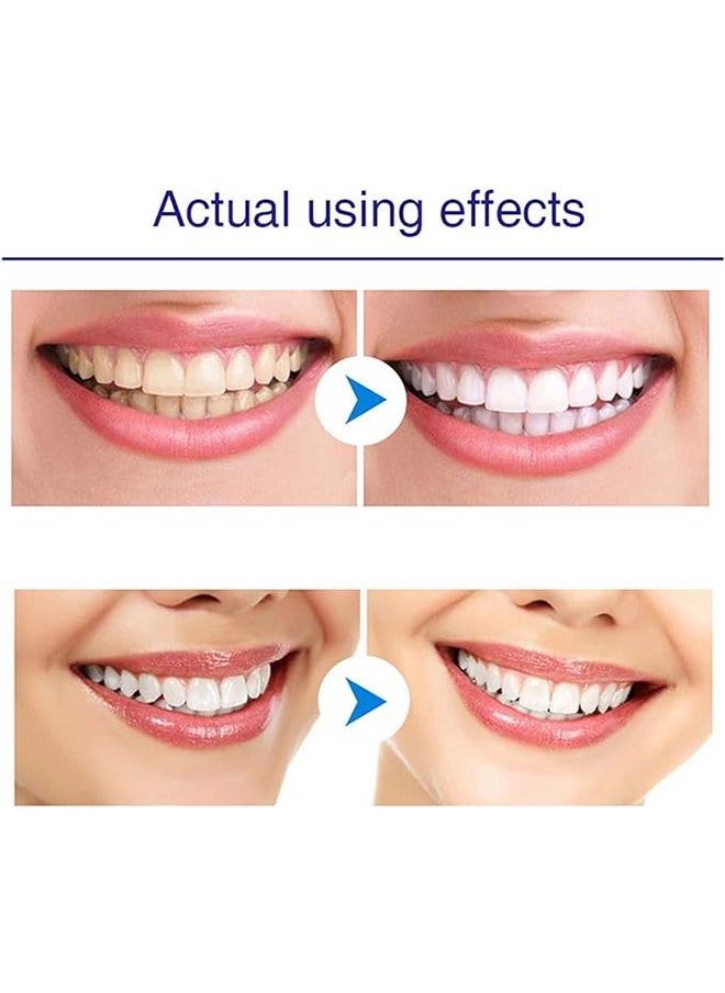 Lanthome Teeth Whitening Pen, Effective, Painless, No Sensitivity, Travel-Friendly, Easy to Use, Beautiful White Smile  - Image 5
