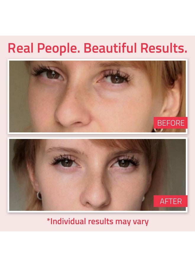 YEOUTH Retinol Eye Cream Anti Aging, Firming Under Eye Cream for Puffiness and Bags Under Eyes for Wrinkles and Dark Circles with Hyaluronic Acid and Tripeptides 15ml - Image 3