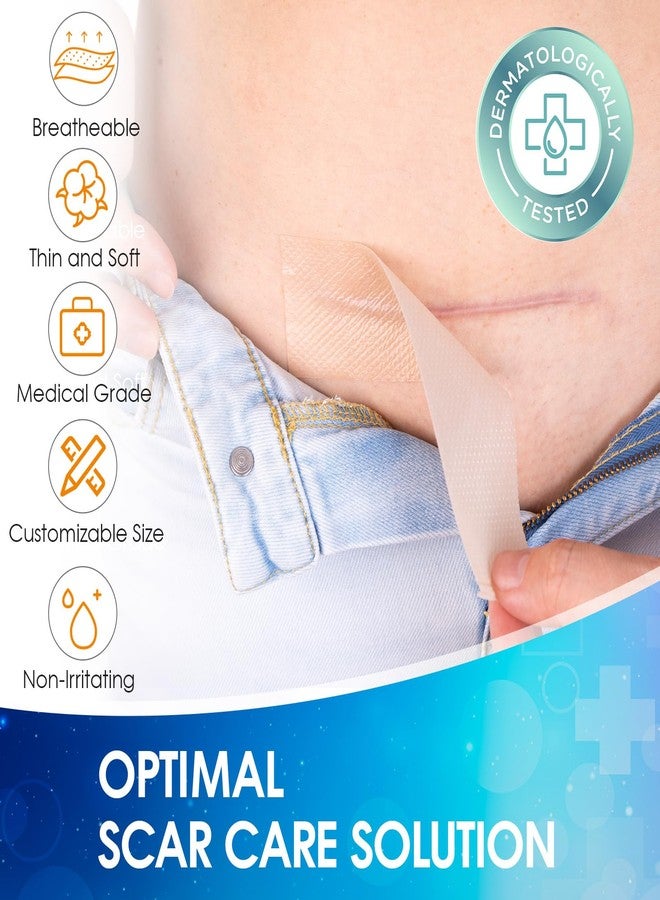 OUJEALEE Silicone Scar Tape, Medical Grade Silicone Scar Sheets for Surgical Scars, Soft & Flexiable Size Silicone Strips for C Section, Keloid, Tummy Tuck, Burn, 1.6" x 60" Roll, 2 Pack - Image 5