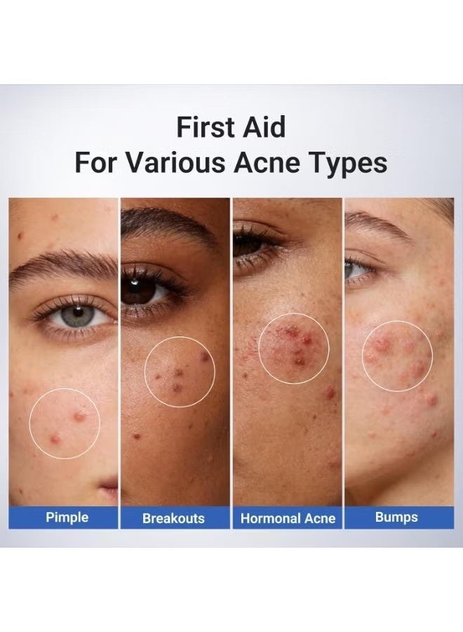 Dr.Leo 1.8% Salicylic Acid Spot Serum, Acne Treatment for Acne-Prone Sensitive Skin | Niacinamide, Fast Pimple Relief, Fades Acne Marks, Overnight & Period Breakouts, 0.34fl oz (20 ml) - Image 4