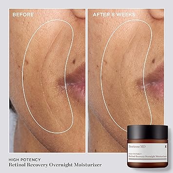 Perricone MD High Potency Retinol Recovery Overnight Moisturizer 59ml - Image 3