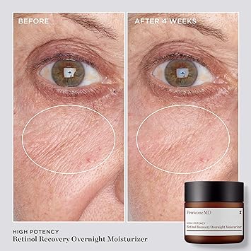 Perricone MD High Potency Retinol Recovery Overnight Moisturizer 59ml - Image 4