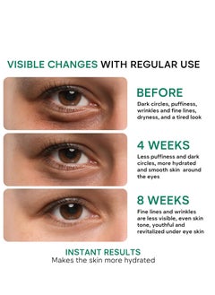REMEDIAL PAX REMEDIAL PAX Eye Cream for Dark Circles and Puffiness, Bags Under Eyes Treatment, Anti-Aging Collagen Eye Cream for Wrinkles, Day & Night Caffeine Eye Cream with Niacinamide Dimethicone  - Image 3