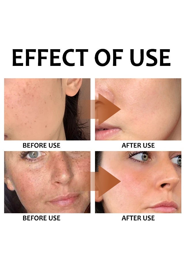 OUHOE lemon turmeric kojic acid facial soap,deep cleansing,brightening skin,skin lightening,cleansing & nourishing 100g - Image 5