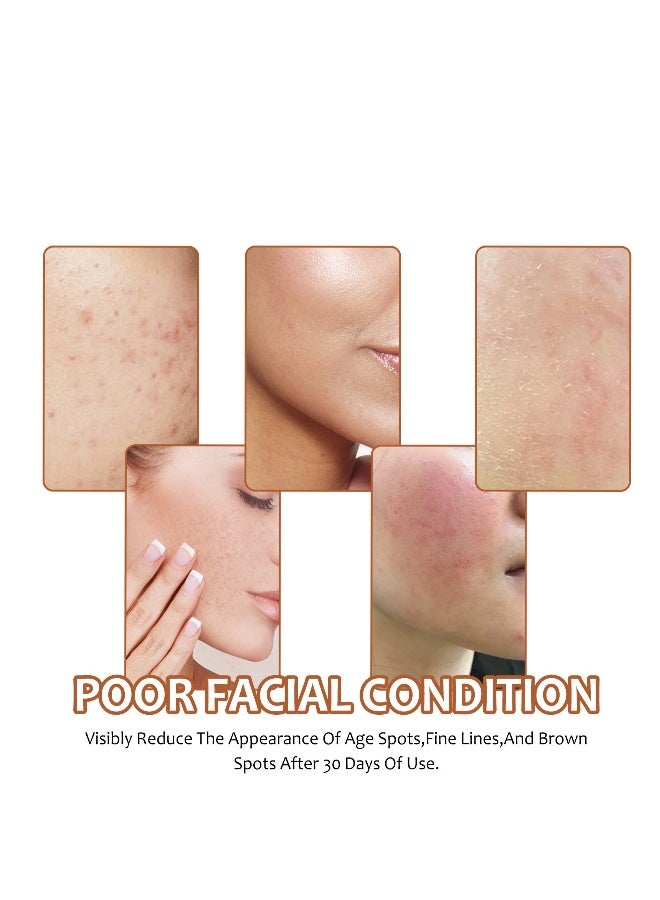 OUHOE lemon turmeric kojic acid facial soap,deep cleansing,brightening skin,skin lightening,cleansing & nourishing 100g - Image 4