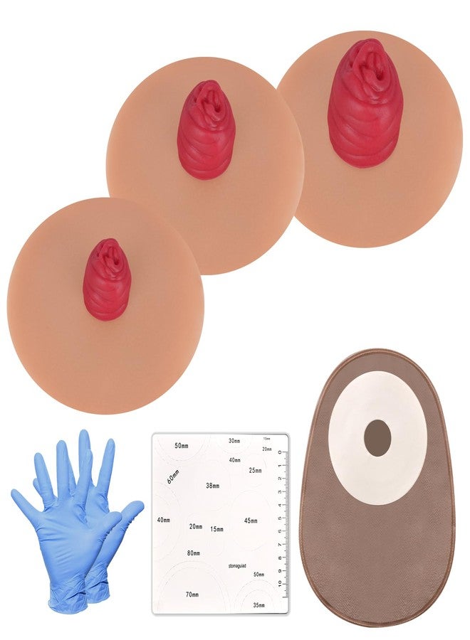 MedEduQuest Sticky Ileostomy Simulators, Stoma Training Model Set, Multi-Skin Tone Ostomy Care Practice Models for Medical Training and Patient Education - Tan - Image 1