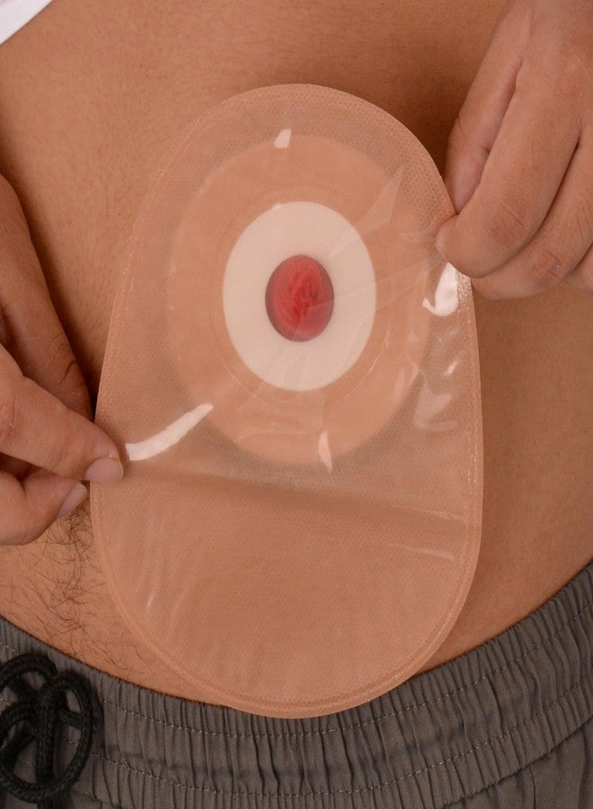 MedEduQuest Sticky Ileostomy Simulators, Stoma Training Model Set, Multi-Skin Tone Ostomy Care Practice Models for Medical Training and Patient Education - Tan - Image 5