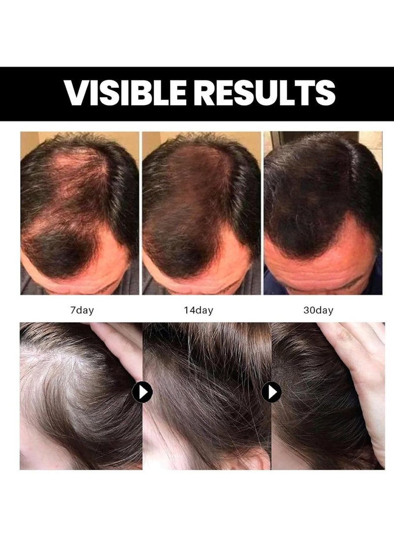 DubaiGallery زيت باتانا العضوي، زيت علاج الشعر، يعزز صحة الشعر وبريق البشرة، مما يمنحك شعرًا أكثر نعومة، 100% طبيعي - Image 4