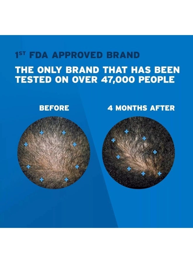 ريجين رغوة روجاين للرجال 5% مينوكسيديل لعلاج تساقط الشعر ونمو الشعر، علاج موضعي للشعر الخفيف، إمداد لمدة 3 أشهر - Image 2