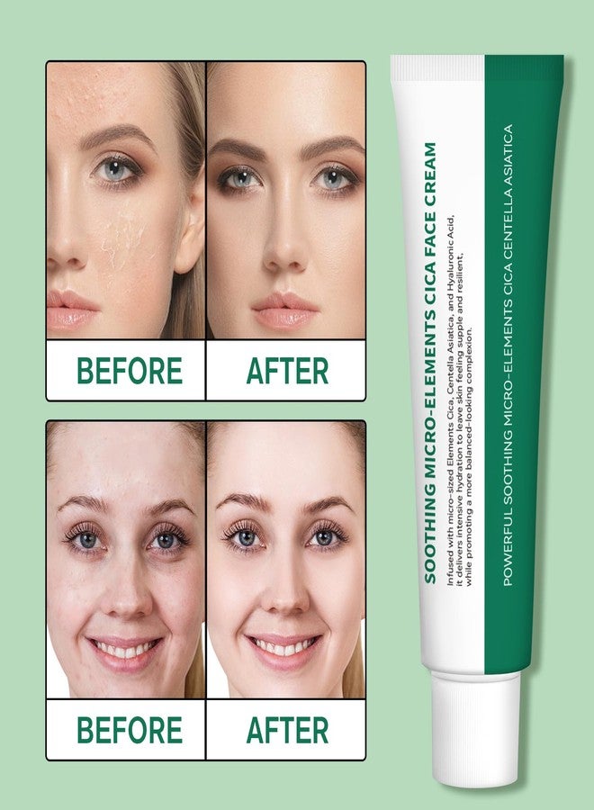 YILEST Centella Asiatica Deep Soothing Cream, Madagascar Centella, Suitable for Dry Skin, Breakouts, Sensitive Skin, Korean Glass Skin Care (50ml / 1.69 fl.oz) - Image 2