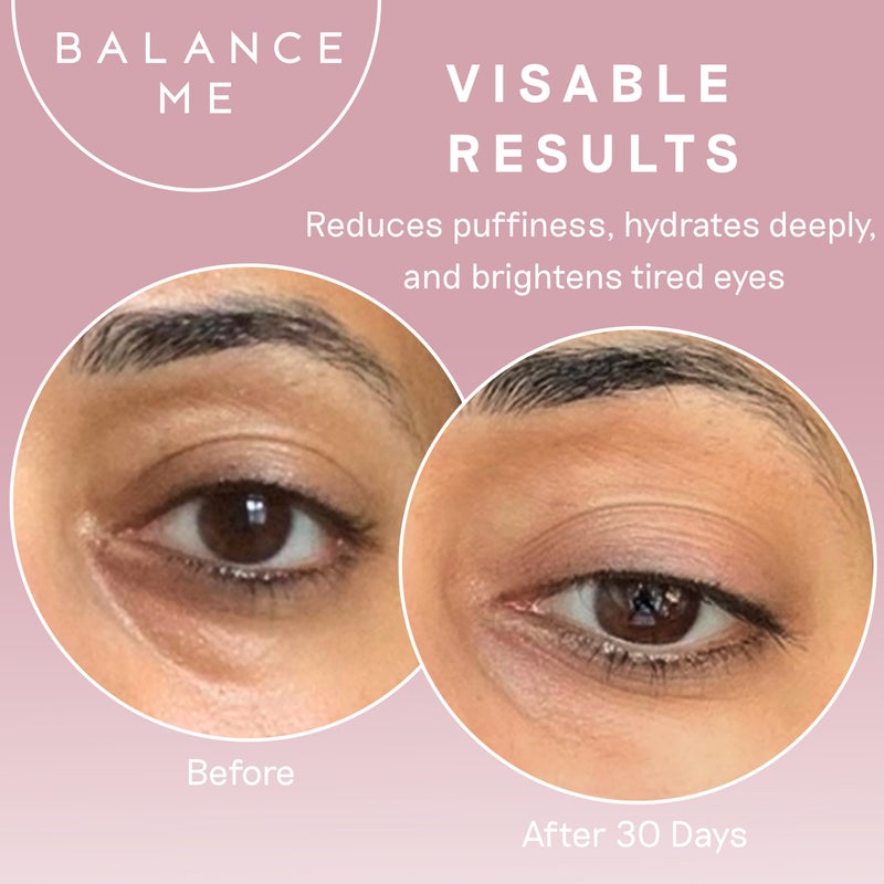 Balance Me Wonder Eye Cream, Dark Circles & Puffy Eyes Treatment with Hyaluronic Acid, Witch Hazel & Cucumber Oil, Anti-Aging, Anti-Wrinkle Eye Cream, (1 x 0.5 fl oz) - Image 5