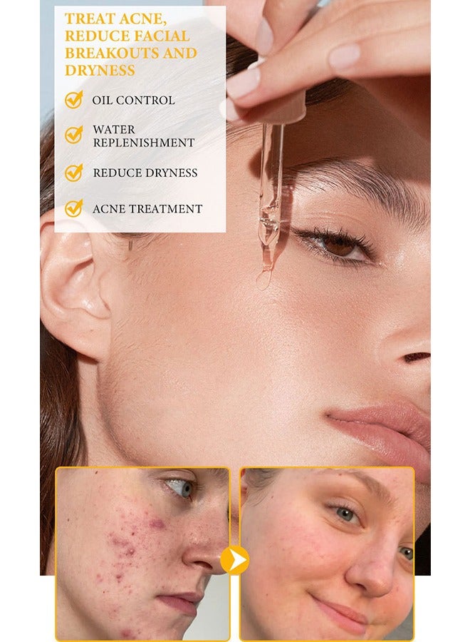 MOOYAM KOJIC ACID Turmeric Solution, All Natural Turmeric Skin Brightening Serum - Cleanses Skin, Fights Acne, Evens Tone, Heals Scars  - Image 5